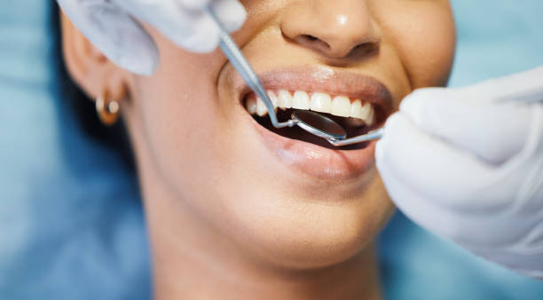 Best Emergency Tooth Extraction in Ashland, OH